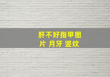 肝不好指甲图片 月牙 竖纹